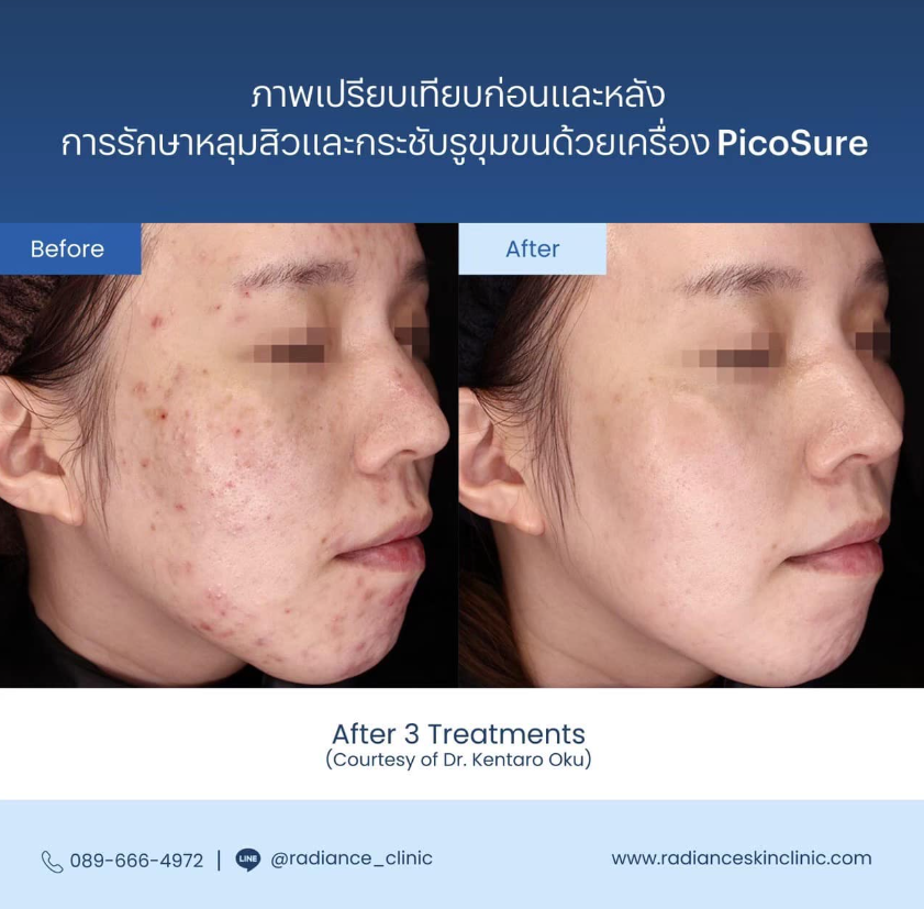 Radiance Clinic Before and After 5