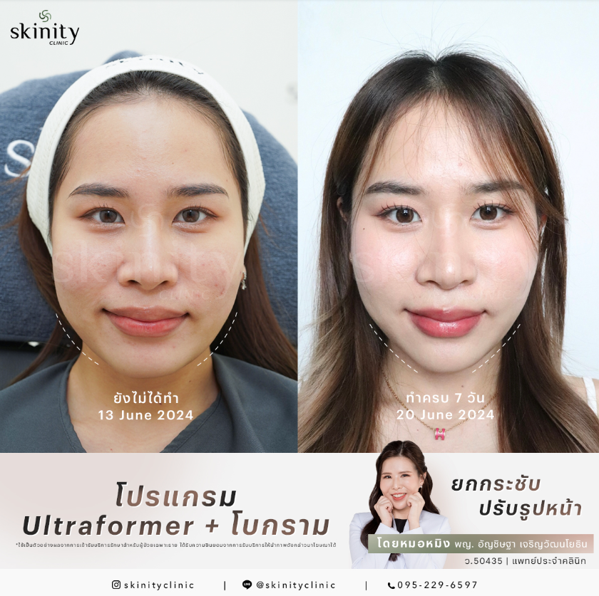 Skinity Clinic 10