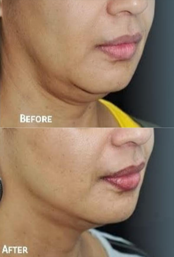 Slender Slimming & Skincare 4