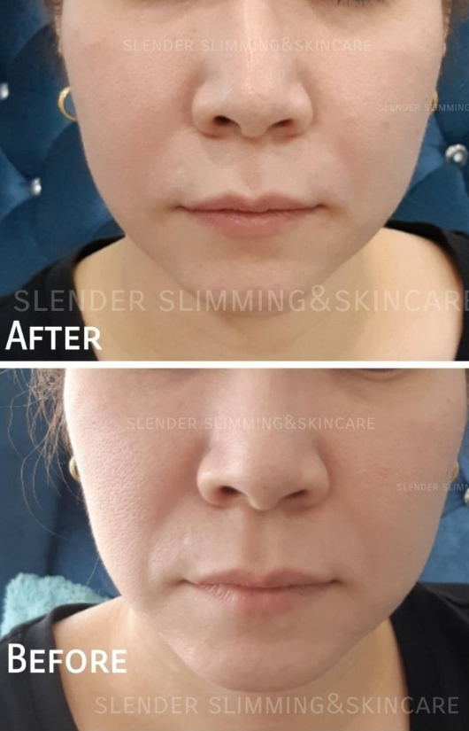 Slender Slimming & Skincare 5