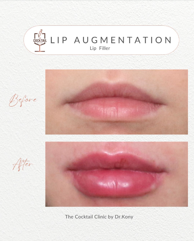 The Cocktail Clinic 4