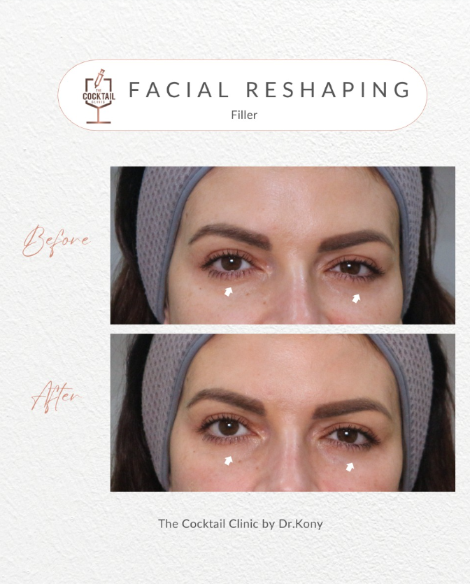 The Cocktail Clinic 8