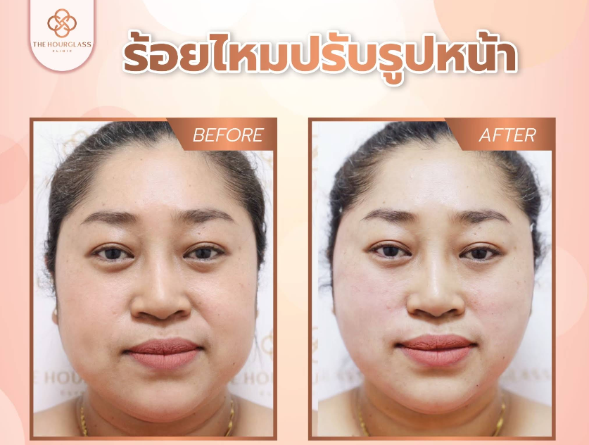 The Hourglass Clinic 9