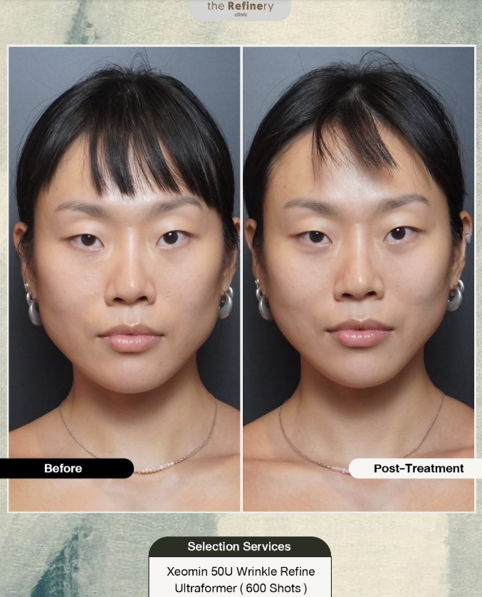 The Refinery Clinic 3