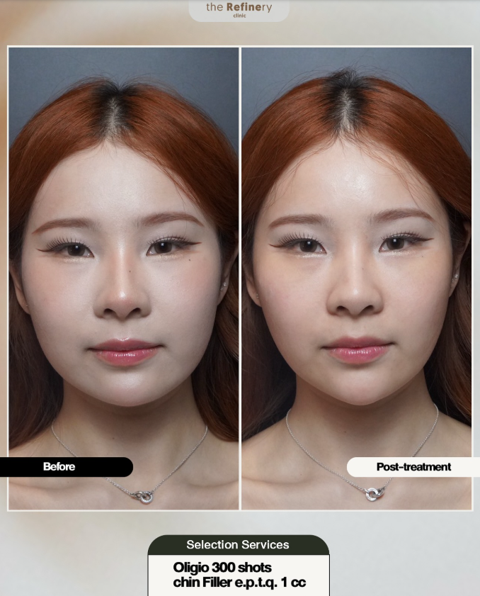 The Refinery Clinic 4