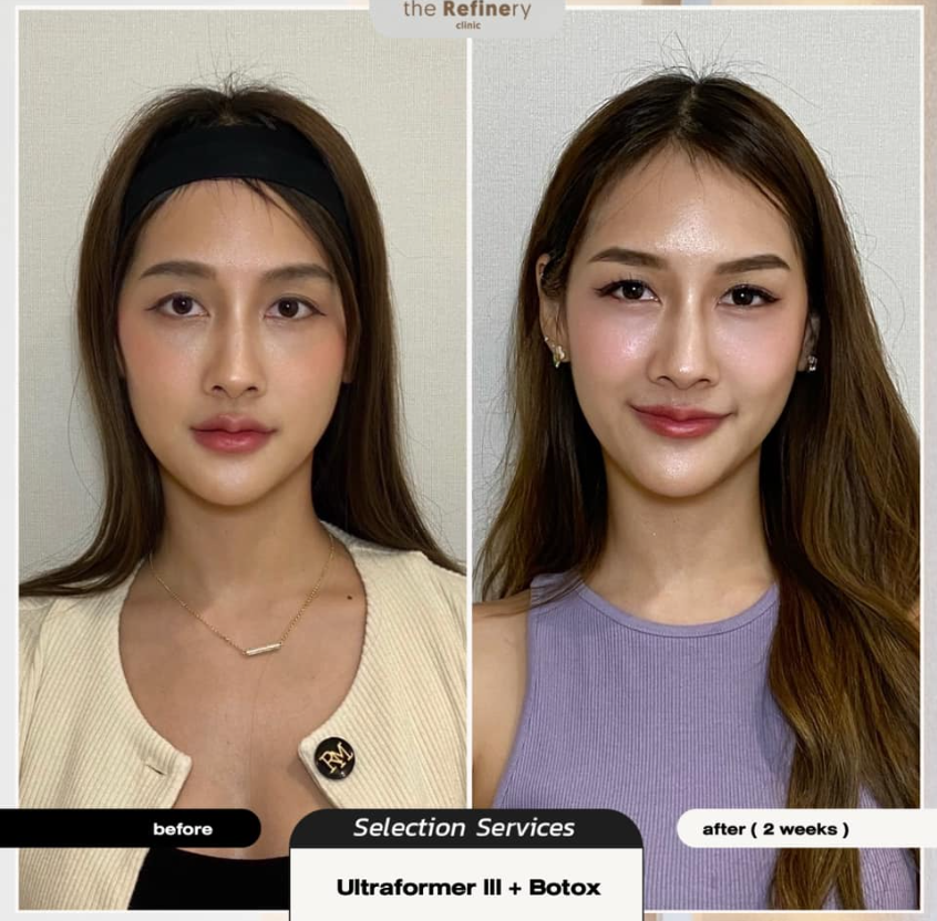 The Refinery Clinic 5