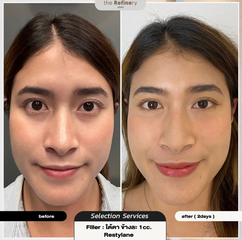 The Refinery Clinic 6