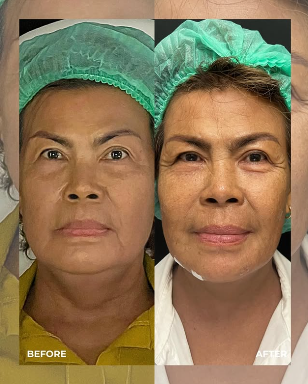 Visage Aesthetic Clinic 4