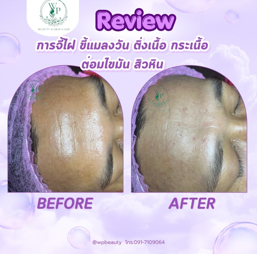WP Skin Care 4