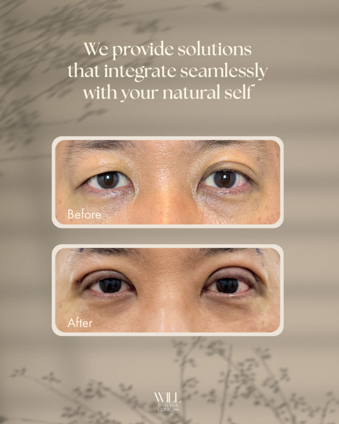 Will Bangkok Clinic 6