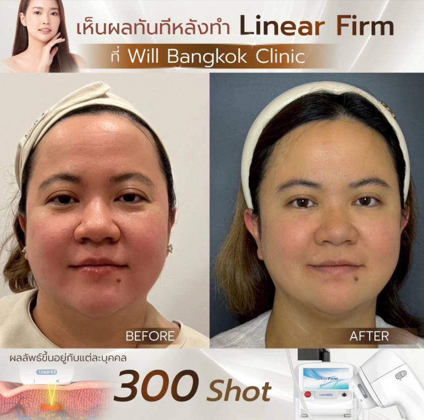 Will Bangkok Clinic 7