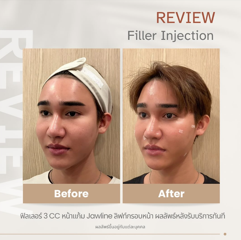 Will Bangkok Clinic 8