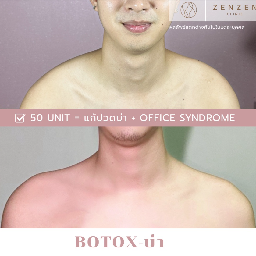 Zenzen Clinic before and after 4