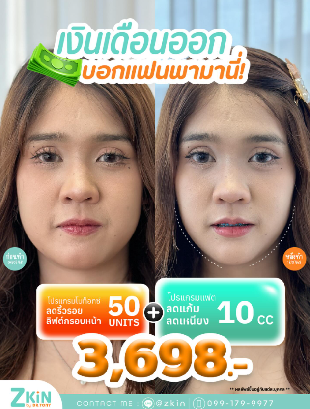 Zkin by Doctor Tony 8