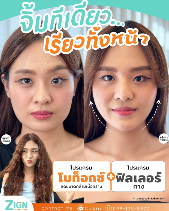 Zkin by Doctor Tony 9