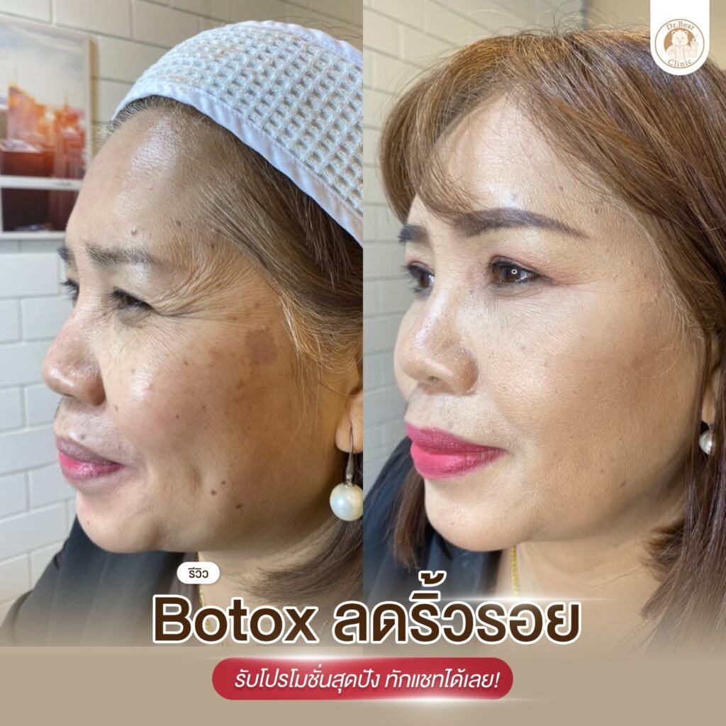 476610018_122197745792182403_7536065612428429909_n