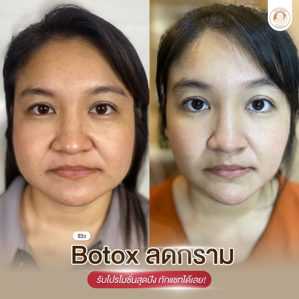 477719851_122197745762182403_5092020498685565561_n