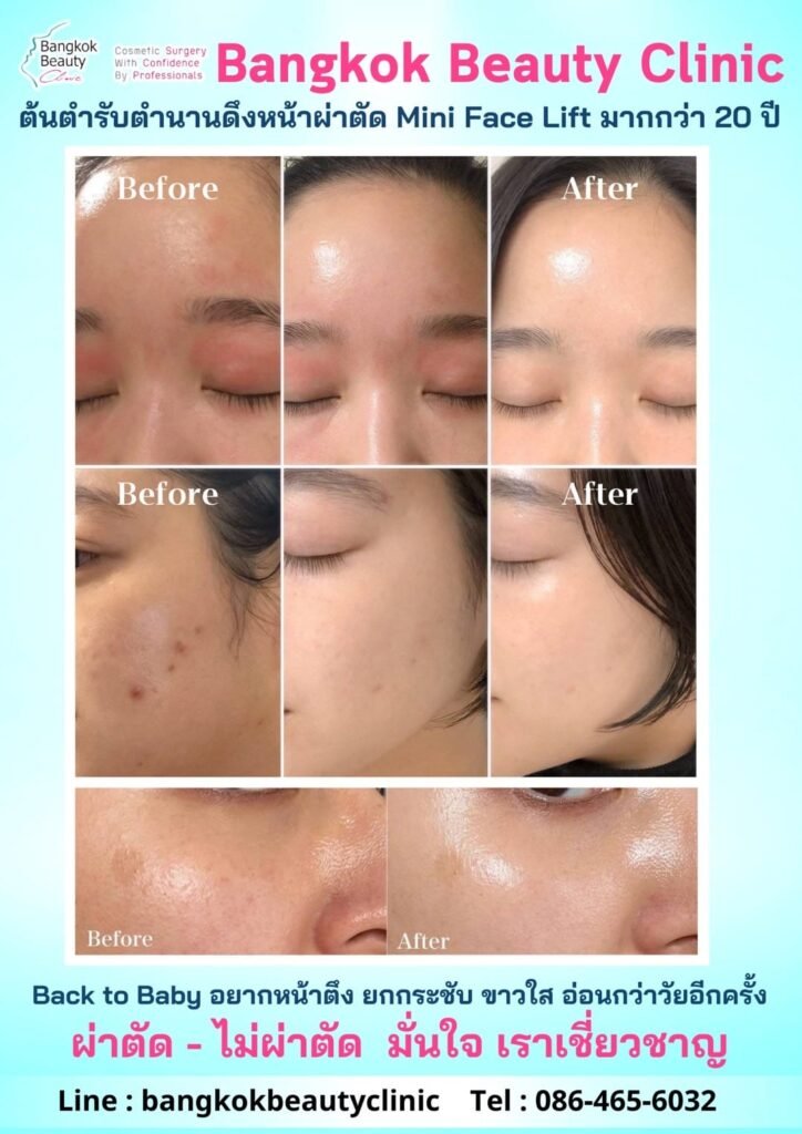 482010665_3451864994944668_8695845961979857355_n