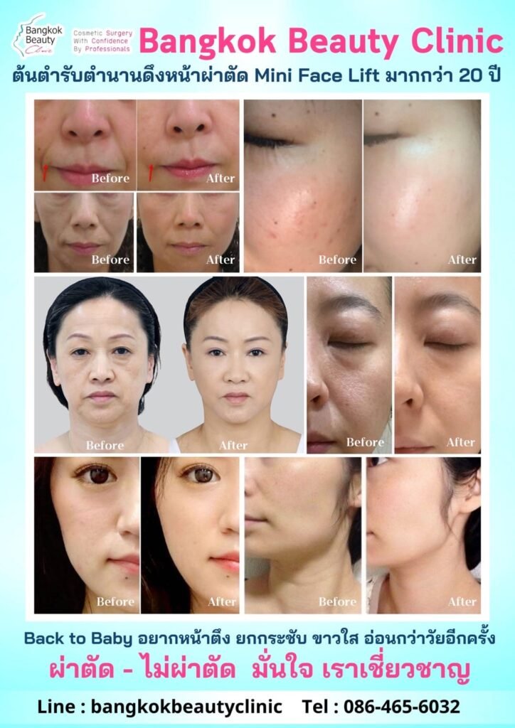 482120755_3451864871611347_5842488518660553635_n