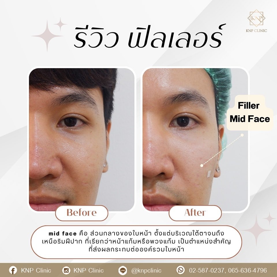 485726734_1071089025056124_7288158508980164365_n