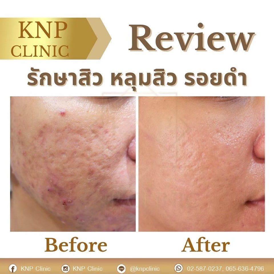 486611768_1075350237963336_91827411639436295_n