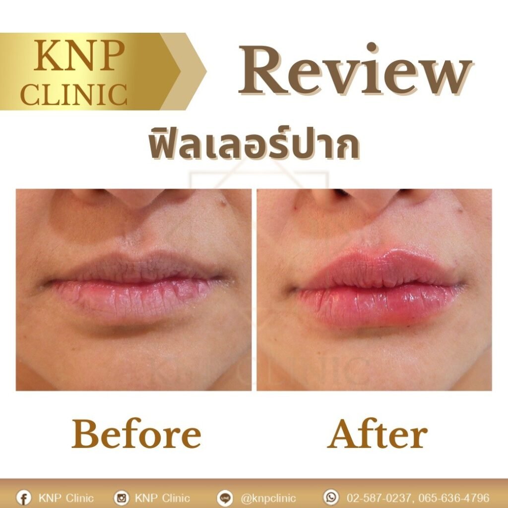 487092418_1074455228052837_2238922157202191185_n