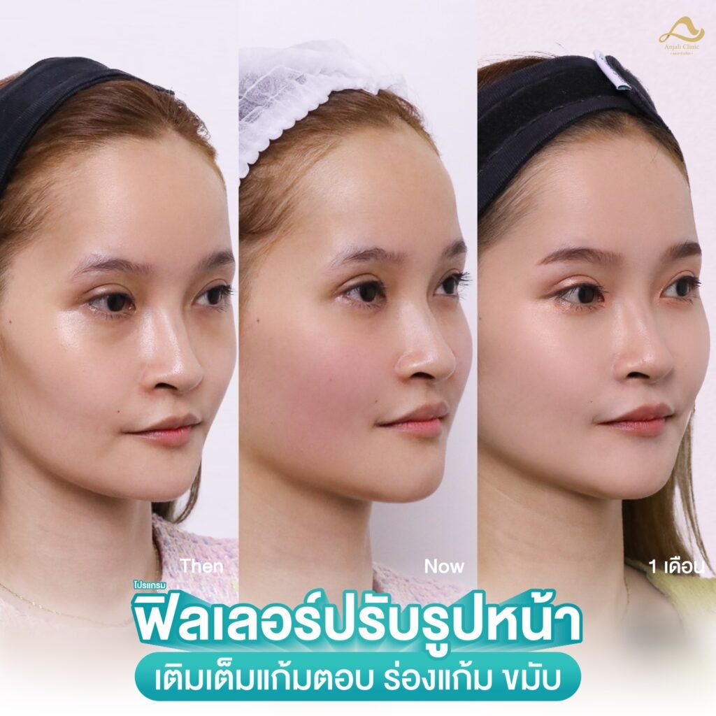 569405256_1275615051269438_9093632654924945253_n