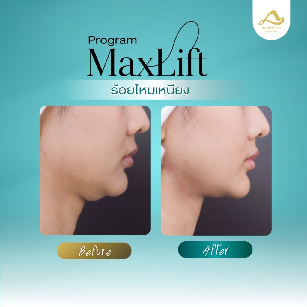 626738602_1361077499389859_8260866267015146372_n