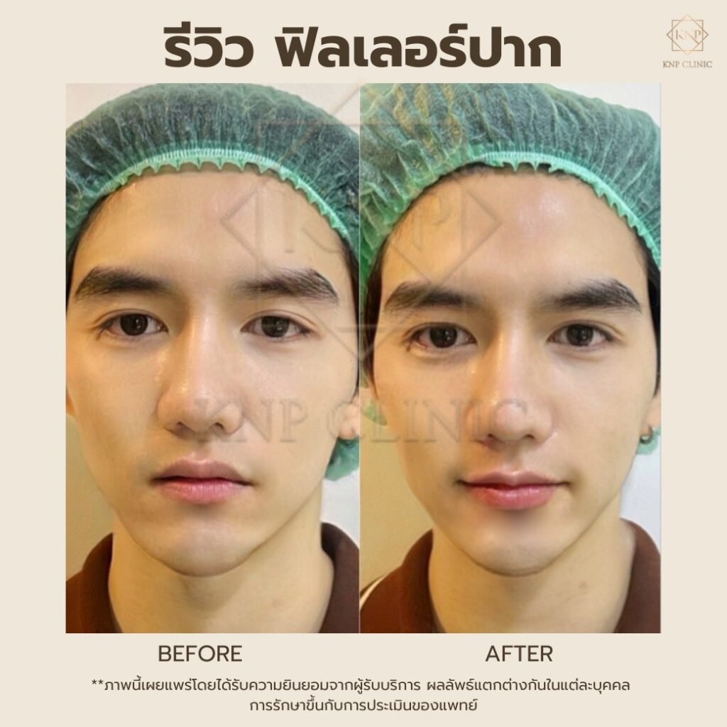 629476418_1340836811414676_5186439931357899863_n