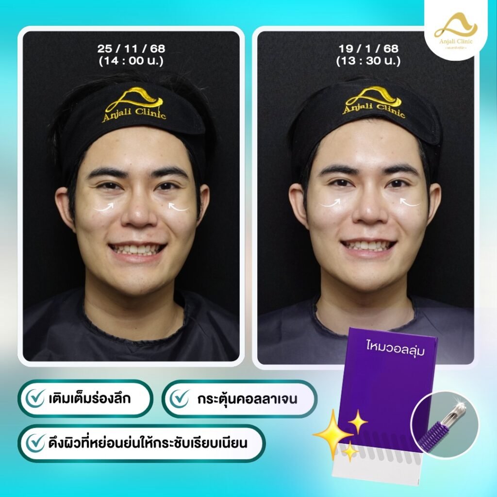 638701251_1375034084660867_3895517667023057702_n