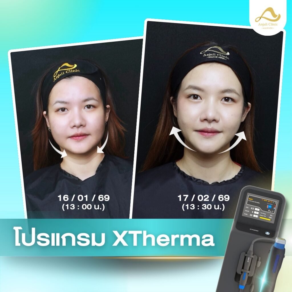 642810493_1378836420947300_629584324653094444_n