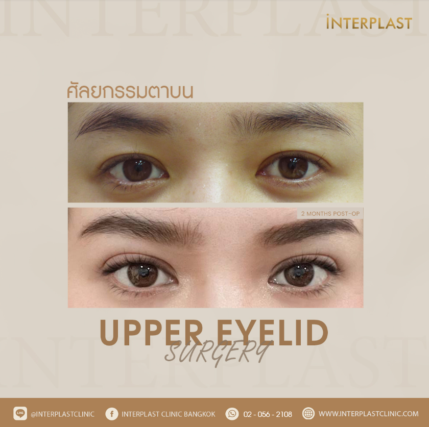 Interplast Clinic 10