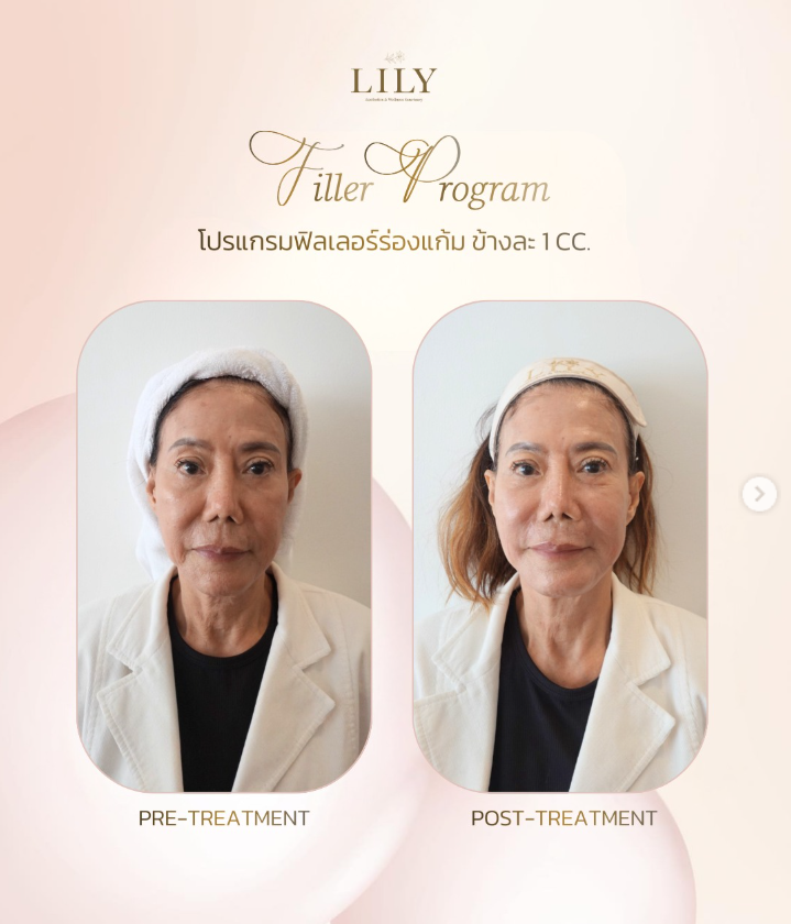 Screenshot 2026-03-03 103136